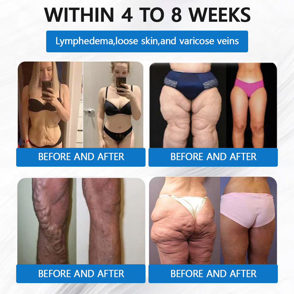 【Last Day Promotion 60% OFF】🥇🥇 LERCEA®Tirzepatide Slimming & health NANO MICRONEEDLE PATCH(Zero Pain, 24/7 Release | Lose 9 kg FAST | 90% Sugar Drop | )