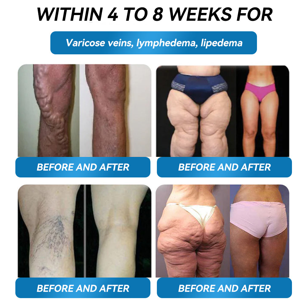𝐎𝐟𝐟𝐢𝐜𝐢𝐚𝐥 𝐔𝐊 𝐂𝐞𝐫𝐭𝐢𝐟𝐢𝐞𝐝👨‍⚕️ 𝐅𝐥𝐚𝐠𝐬𝐡𝐢𝐩 𝐒𝐭𝐨𝐫𝐞 𝐃𝐢𝐫𝐞𝐜𝐭 𝐒𝐚𝐥𝐞𝐬||💕 𝐋𝙀𝑹𝐂𝑬𝗔® 𝐆𝙇𝐏-𝟏 𝑴𝒆𝒕𝒂𝒃𝒐𝒍𝒊𝒄 𝑩𝒂𝒍𝒂𝒏𝒄𝒆 𝑶𝒓𝒂𝒍 𝑨𝒎𝒑𝒐𝒖𝒍𝒆𝒔: 𝐒𝐮𝐢𝐭𝐚𝐛𝐥𝐞 𝐟𝐨𝐫 𝐨𝐛𝐞𝐬𝐢𝐭𝐲, 𝐜𝐚𝐫𝐝𝐢𝐨𝐯𝐚𝐬𝐜𝐮𝐥𝐚𝐫 𝐝𝐢𝐬𝐞𝐚𝐬𝐞𝐬, 𝐝𝐢𝐚𝐛𝐞𝐭𝐞𝐬, 𝐬𝐥𝐞𝐞𝐩 𝐚𝐩𝐧𝐞𝐚 𝐬𝐲𝐧𝐝𝐫𝐨𝐦𝐞, 𝐣𝐨𝐢𝐧𝐭 𝐢𝐬𝐬𝐮𝐞𝐬, 𝐚𝐧𝐝 𝐦𝐨𝐫𝐞 💎