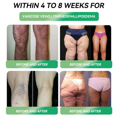 𝐎𝐟𝐟𝐢𝐜𝐢𝐚𝐥 𝐔𝐊 𝐂𝐞𝐫𝐭𝐢𝐟𝐢𝐞𝐝👨‍⚕️ 𝐅𝐥𝐚𝐠𝐬𝐡𝐢𝐩 𝐒𝐭𝐨𝐫𝐞 𝐃𝐢𝐫𝐞𝐜𝐭 𝐒𝐚𝐥𝐞𝐬 |🏅𝐋𝙀𝑹𝐂𝗘𝗔® 𝑮𝗟𝐏-𝟭𝑴𝒆𝒕𝒂𝒃𝒐𝒍𝒊𝒄 𝑩𝒂𝒍𝒂𝒏𝒄𝒆 𝑶𝒓𝒂𝒍 𝑨𝒎𝒑𝒐𝒖𝒍𝒆𝒔: 𝑶𝒃𝒆𝒔𝒊𝒕𝒚,𝐂𝐚𝐫𝐝𝐢𝐨𝐯𝐚𝐬𝐜𝐮𝐥𝐚𝐫 𝐃𝐢𝐬𝐞𝐚𝐬𝐞𝐬, 𝐃𝐢𝐚𝐛𝐞𝐭𝐞𝐬,𝗦𝗹𝗲𝗲𝗽 𝗔𝗽𝗻𝗲𝗮 𝗦𝘆𝗻𝗱𝗿𝗼𝗺𝗲, 𝗝𝗼𝗶𝗻𝘁 𝗜𝘀𝘀𝘂𝗲𝘀, 𝗲𝘁𝗰💕